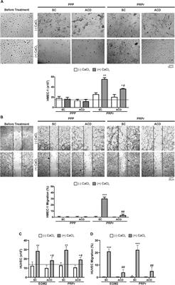 Anticoagulants Interfere With the Angiogenic and Regenerative Responses Mediated by Platelets